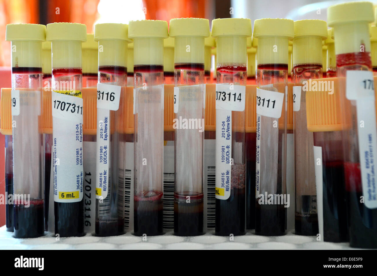 I campioni di sangue in tubi di prova Foto Stock
