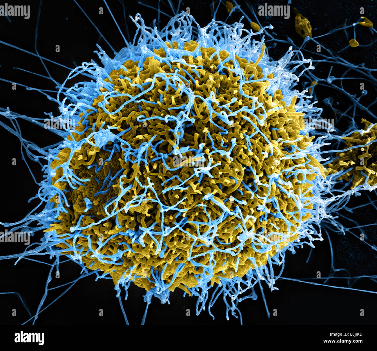 Vista microscopica del virus Ebola. Colorati scanning electron microfotografia di filamentosi virus Ebola particelle attaccate a e nascenti da una cronicamente infette VERO E6 cell. Foto Stock