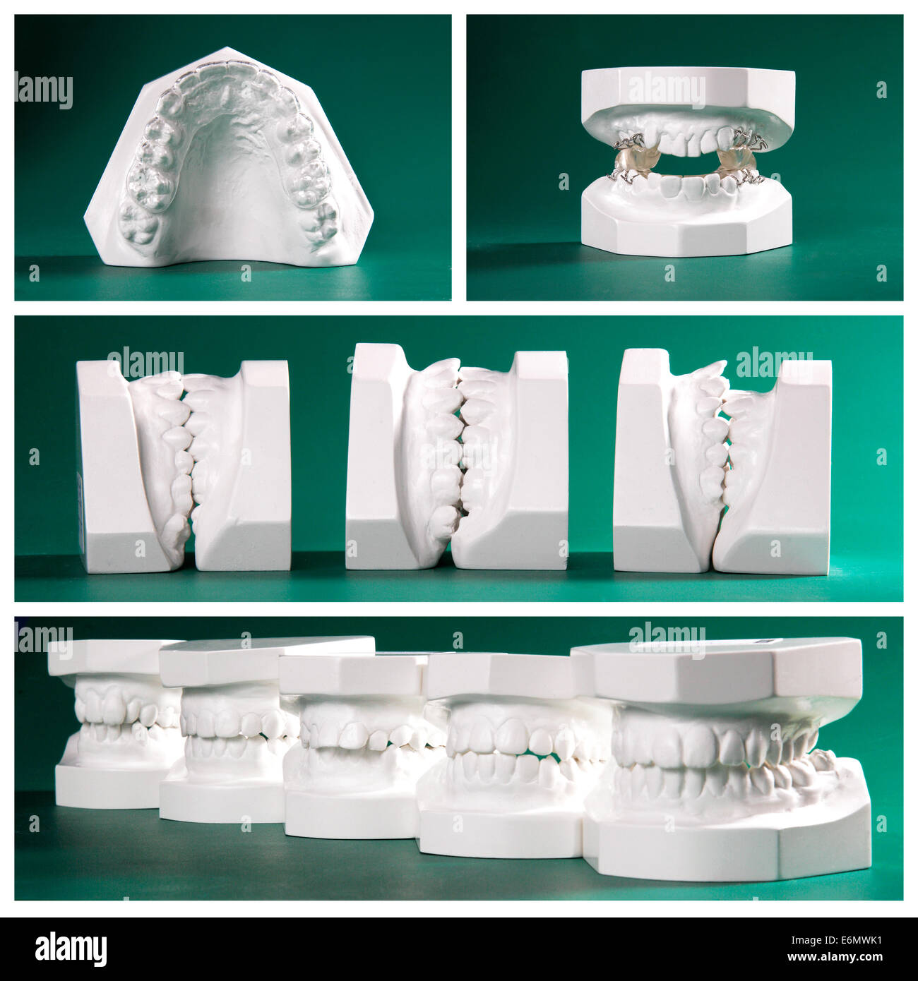 Raccolta foto di studio dentale modelli su sfondo verde Foto Stock