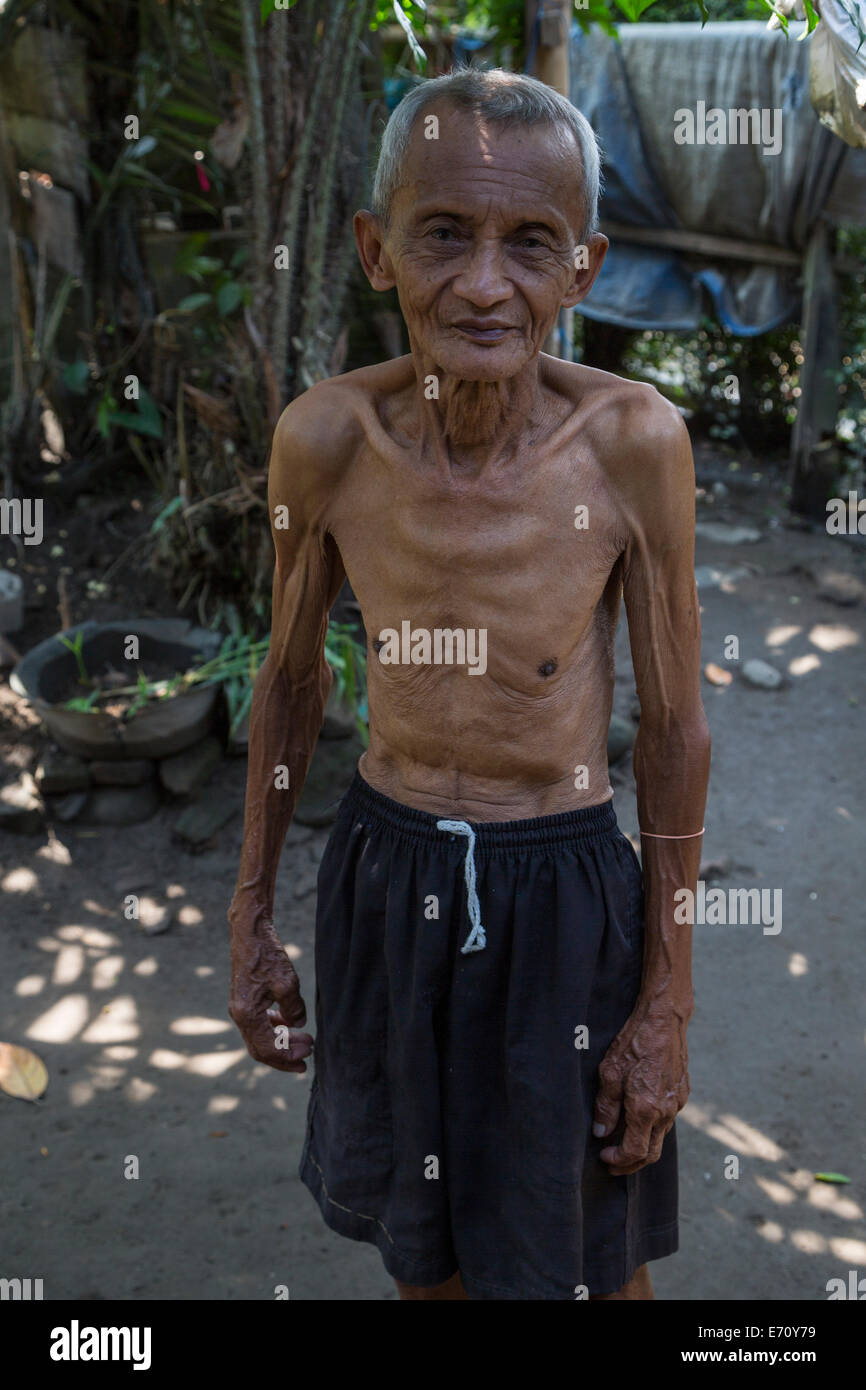 Borobudur, Java, Indonesia. Emaciated Indonesian Man. Foto Stock