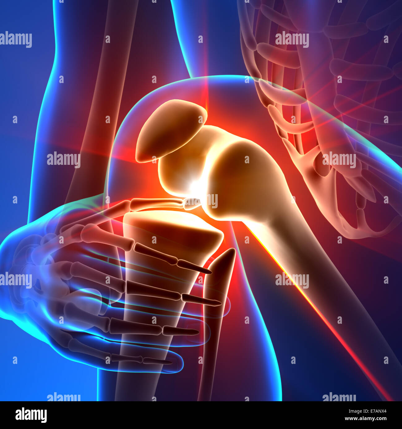 Il dolore al ginocchio - Anatomia raggi Foto Stock