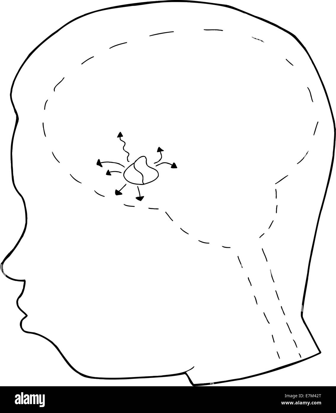 Profilo della testa umana con la ghiandola pituitaria Foto Stock