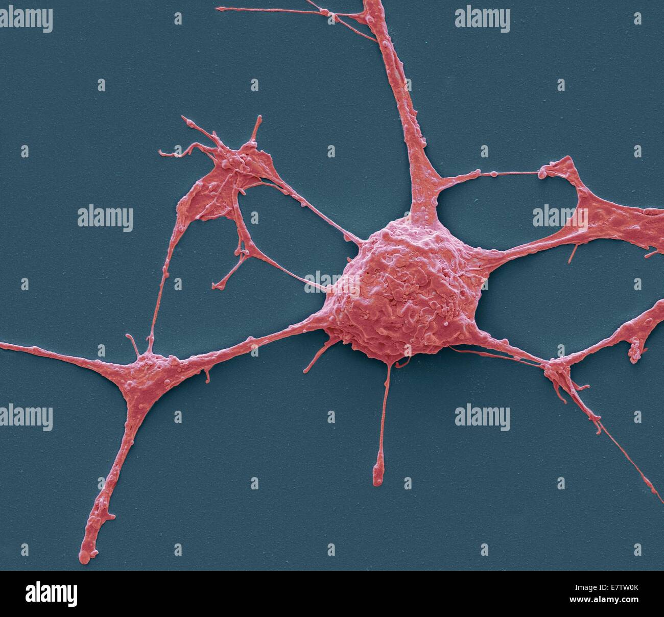 Neurone. Micrografia al microscopio elettronico a scansione (SEM) di un PC12 neurone nella cultura.La linea cellulare PC12, sviluppato da un feocromocitoma tumore del ratto del midollo surrenale è diventata una premiere modello per lo studio della differenziazione neuronale. Quando trattate nella cultura Foto Stock Neurone. Micrografia al microscopio elettronico a scansione (SEM) di un PC12 neurone nella cultura.La linea cellulare PC12, sviluppato da un feocromocitoma tumore del ratto del midollo surrenale è diventata una premiere modello per lo studio della differenziazione neuronale. Quando trattate nella cultura Foto Stock