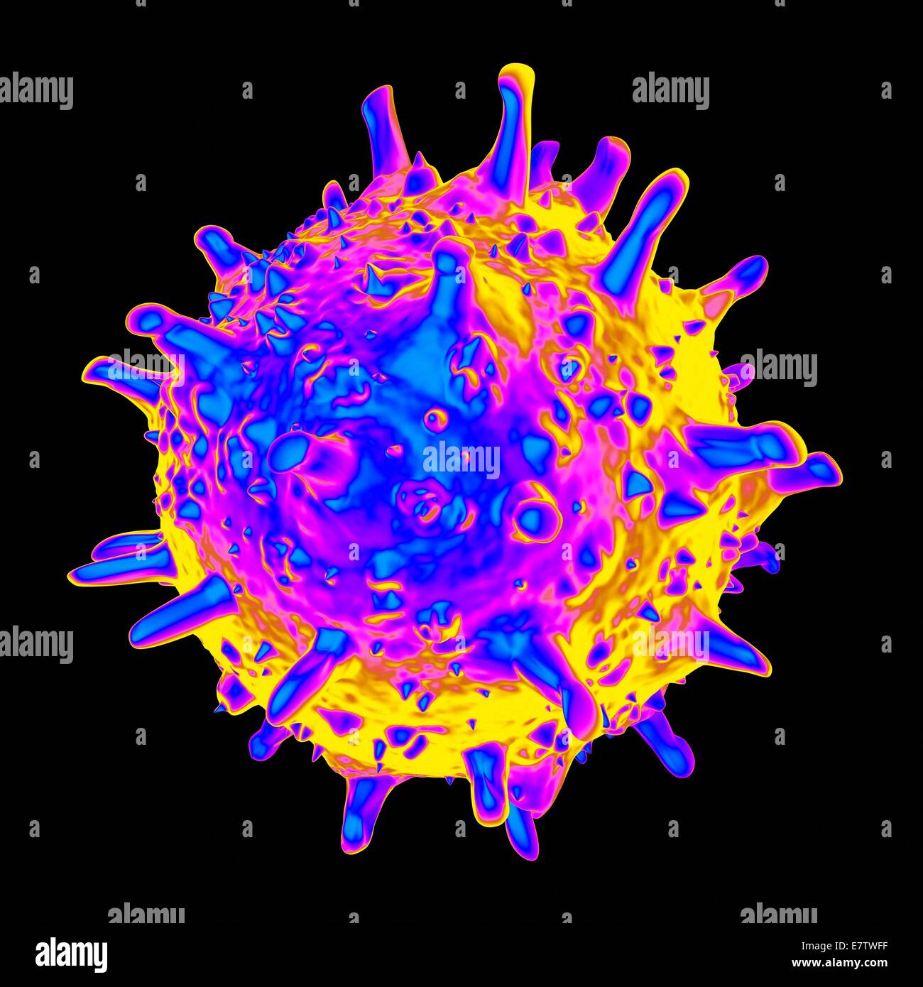 Sindrome respiratoria acuta grave (SARS), computer grafica. Foto Stock