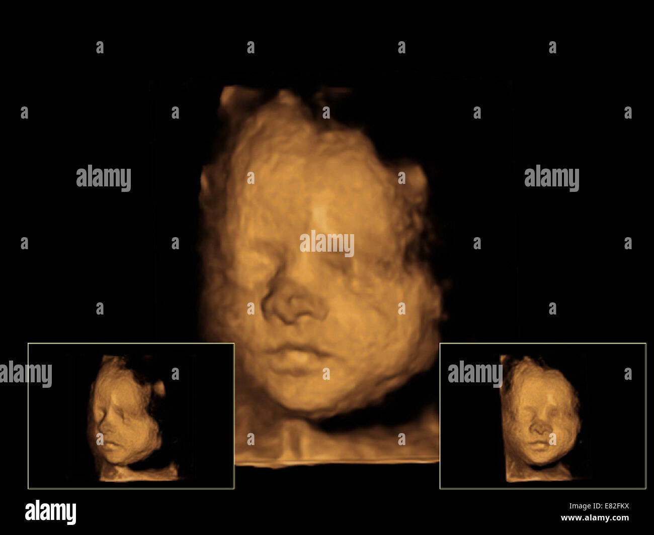 Feto A 28 Settimane Immagini E Fotos Stock Alamy