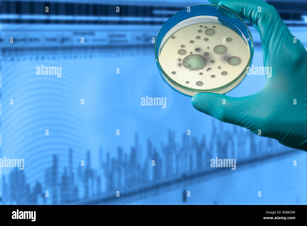 Le colonie di microrganismi patogeni in una capsula di petri Foto Stock