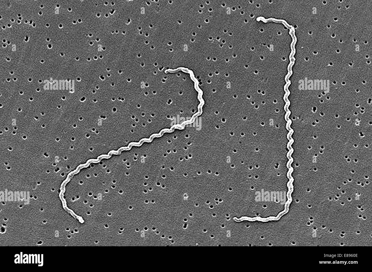 Micrografia elettronica a scansione della presenza di Leptospira interrogans ceppo RGA. Due spirochete legato ad un filtro da 0,2 um. Foto Stock