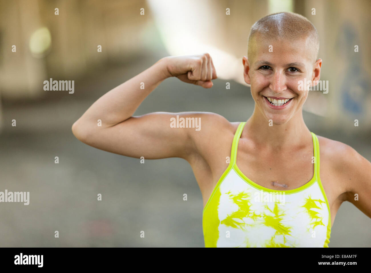 Ritratto di determinata giovane femmina superstite del cancro Foto Stock