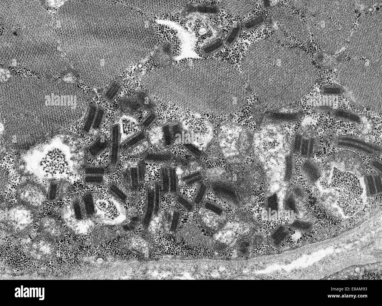 Muscolo anormale, mitocondri Foto Stock