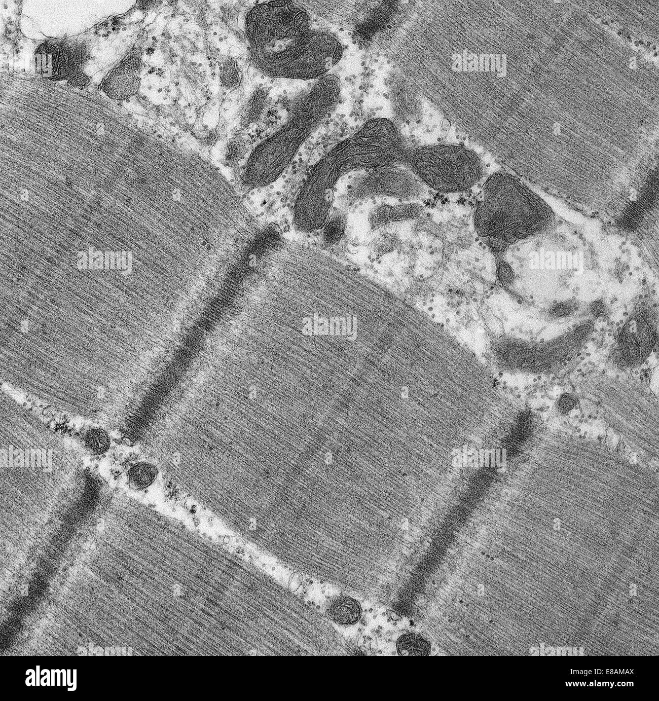 Muscolare normale Foto Stock