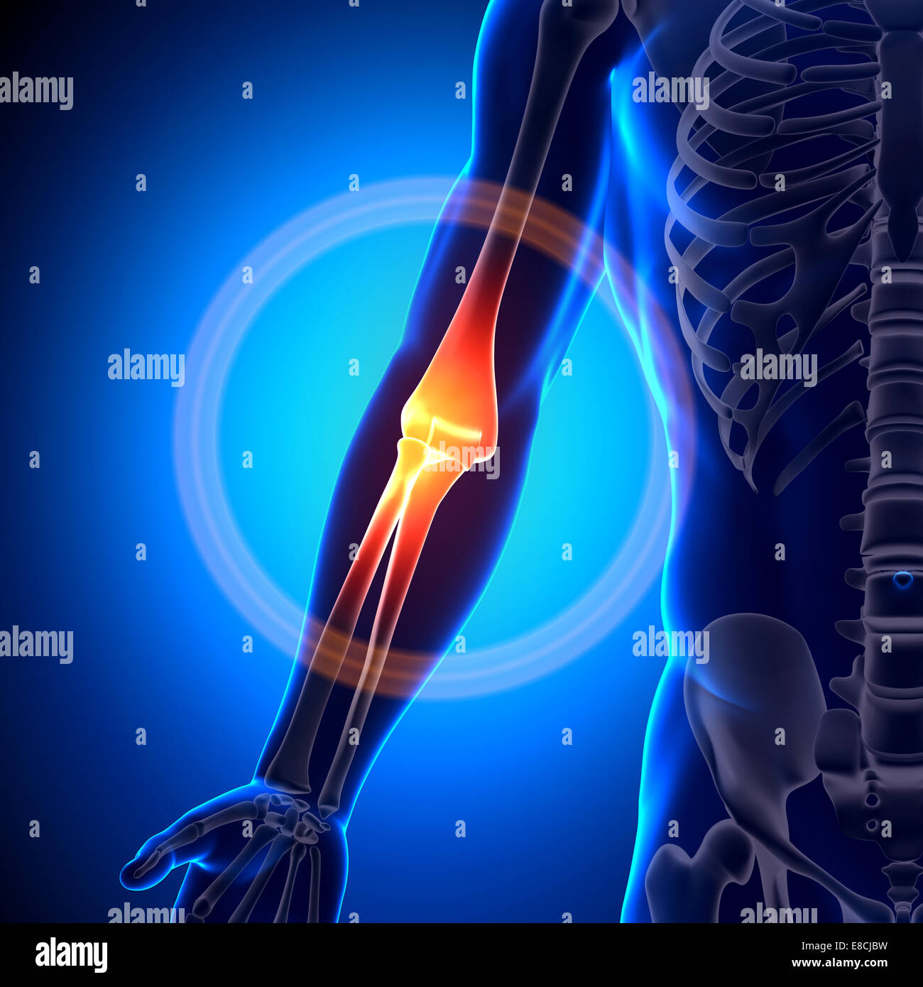 Il gomito anatomia - Anatomia ossa Foto Stock