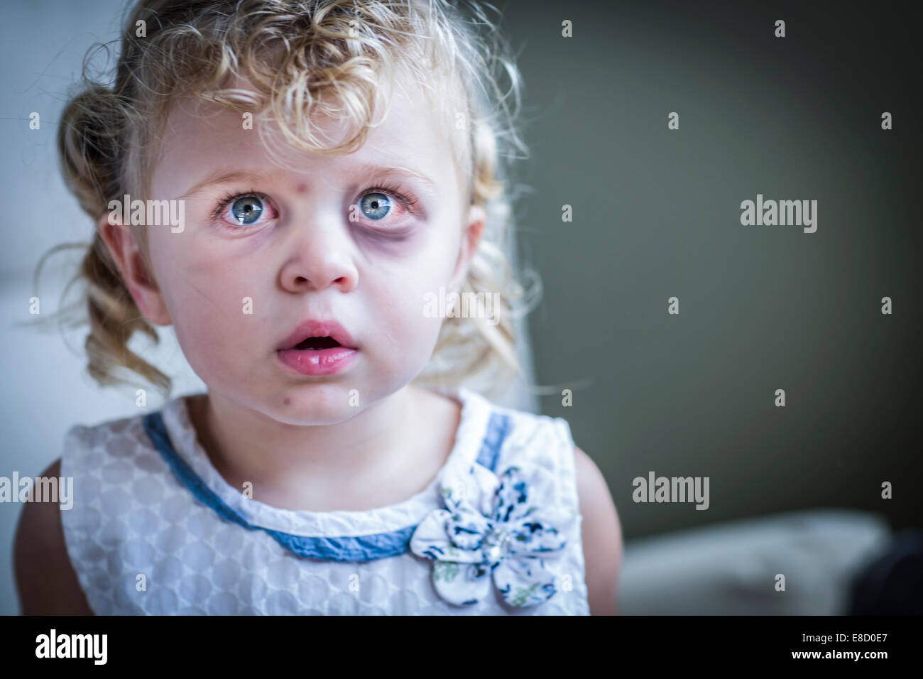 Triste e spaventato Bambina con sanguinari e ferito gli occhi. Foto Stock