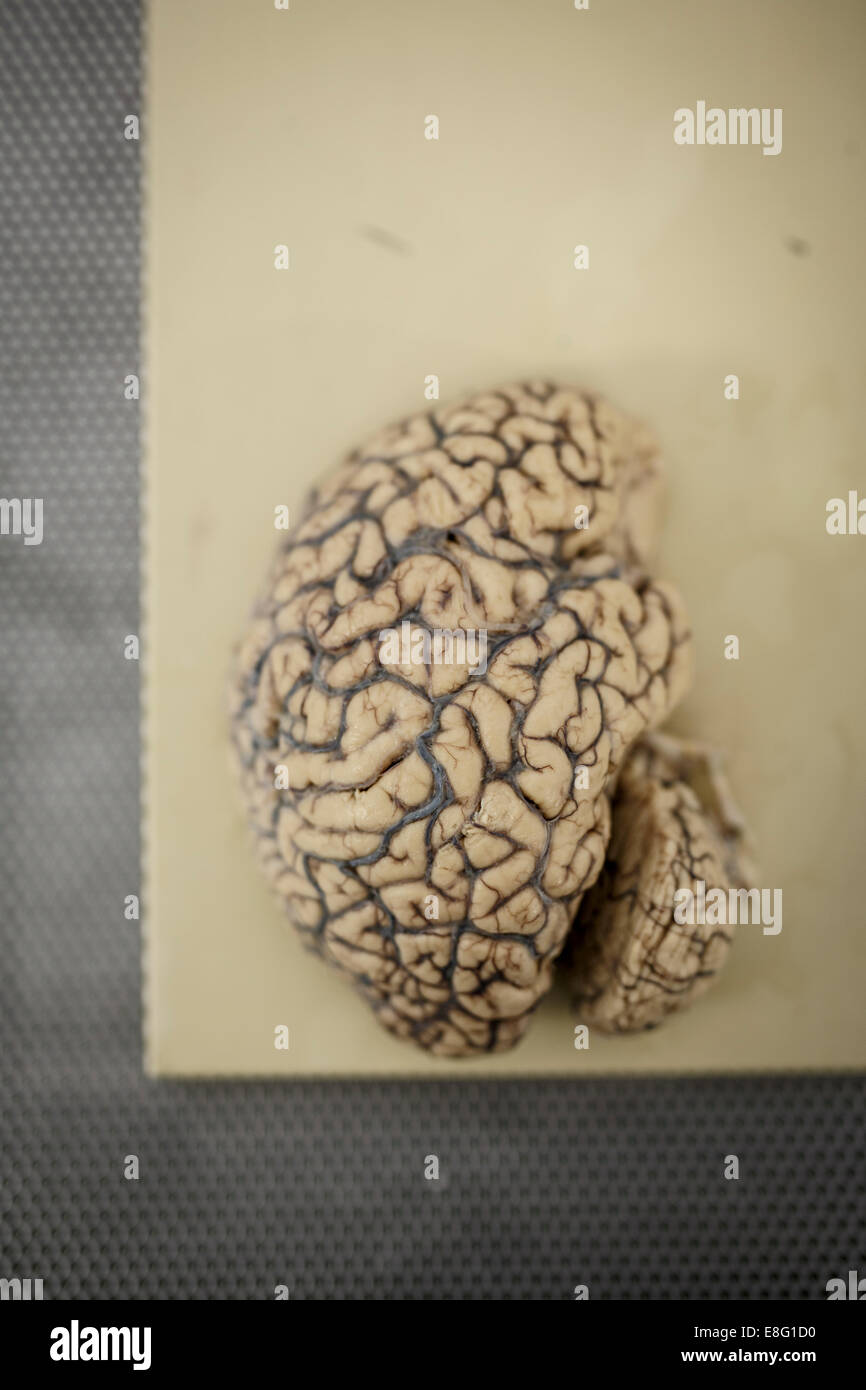 Cervello umano dissecare per test medici demenza Foto Stock