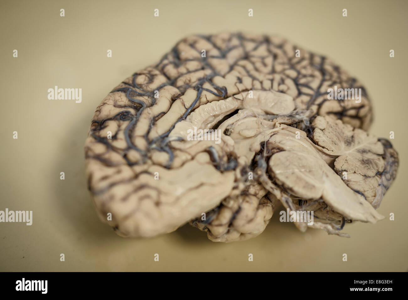 Cervello umano dissecare per test medici demenza Foto Stock