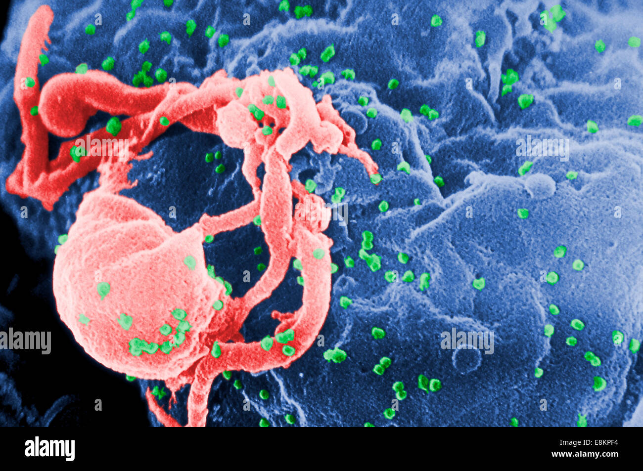 Micrografia elettronica a scansione di HIV-1 germogliando da linfociti coltivati più round protuberanze sulla superficie cellulare rappresentano siti di Foto Stock