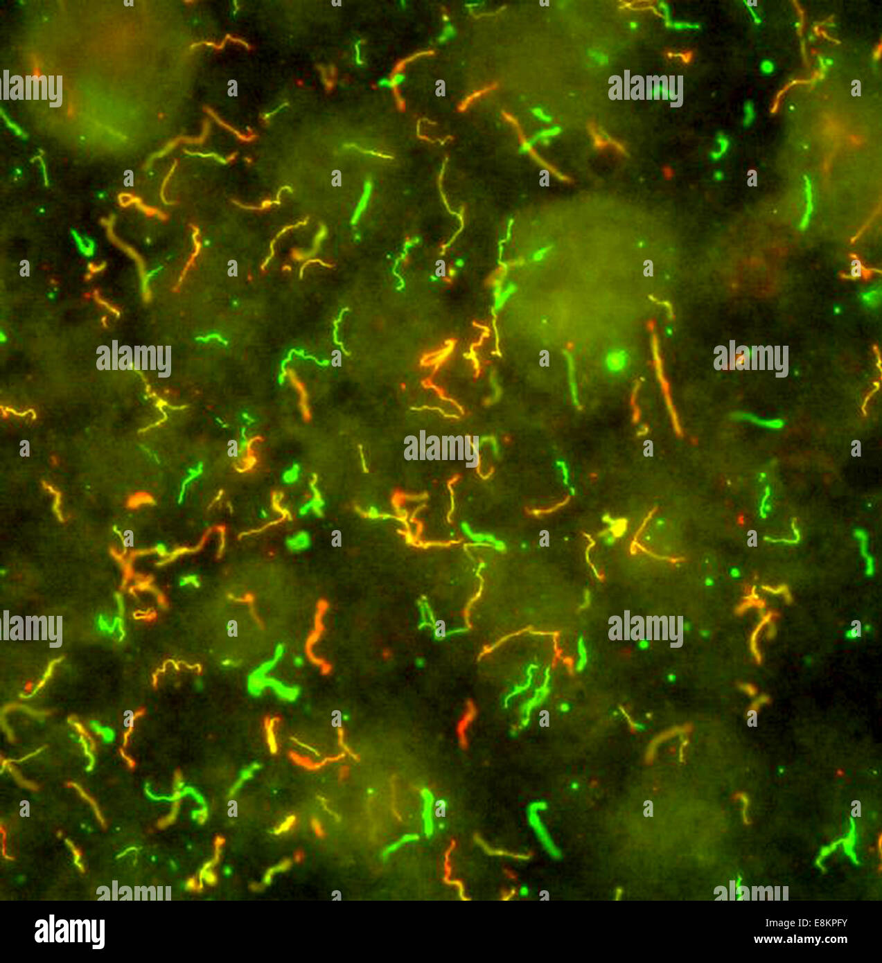 La Malattia di Lyme batteri, Borrelia burgdorferi malattia di Lyme spirocheta, Borrelia burgdorferi, è un parassita obbligato che i cicli Foto Stock