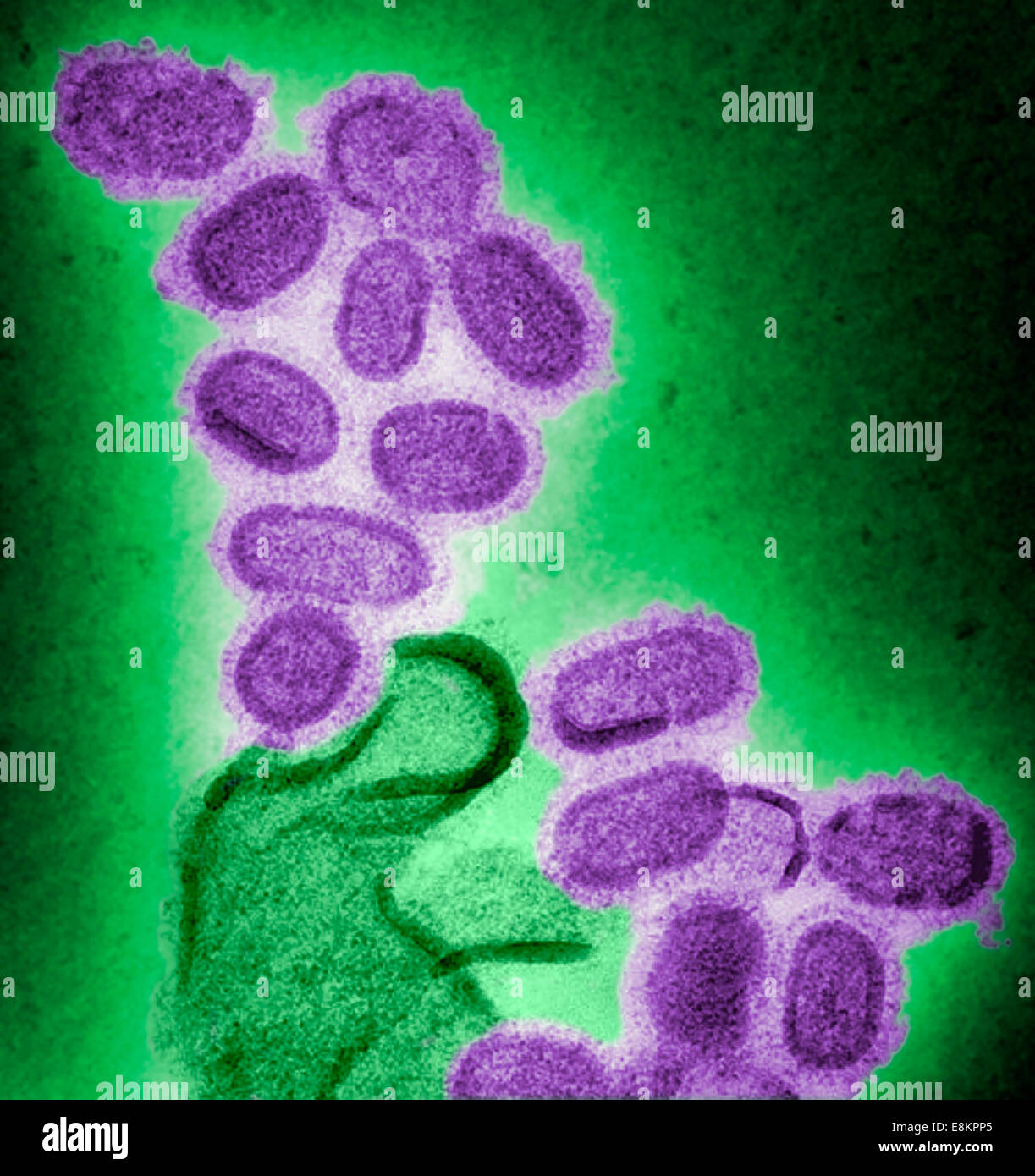 Questo colorato colorato negativo microscopio elettronico a trasmissione (TEM) mostra ricreato 1918 virioni influenzali che sono stati Foto Stock