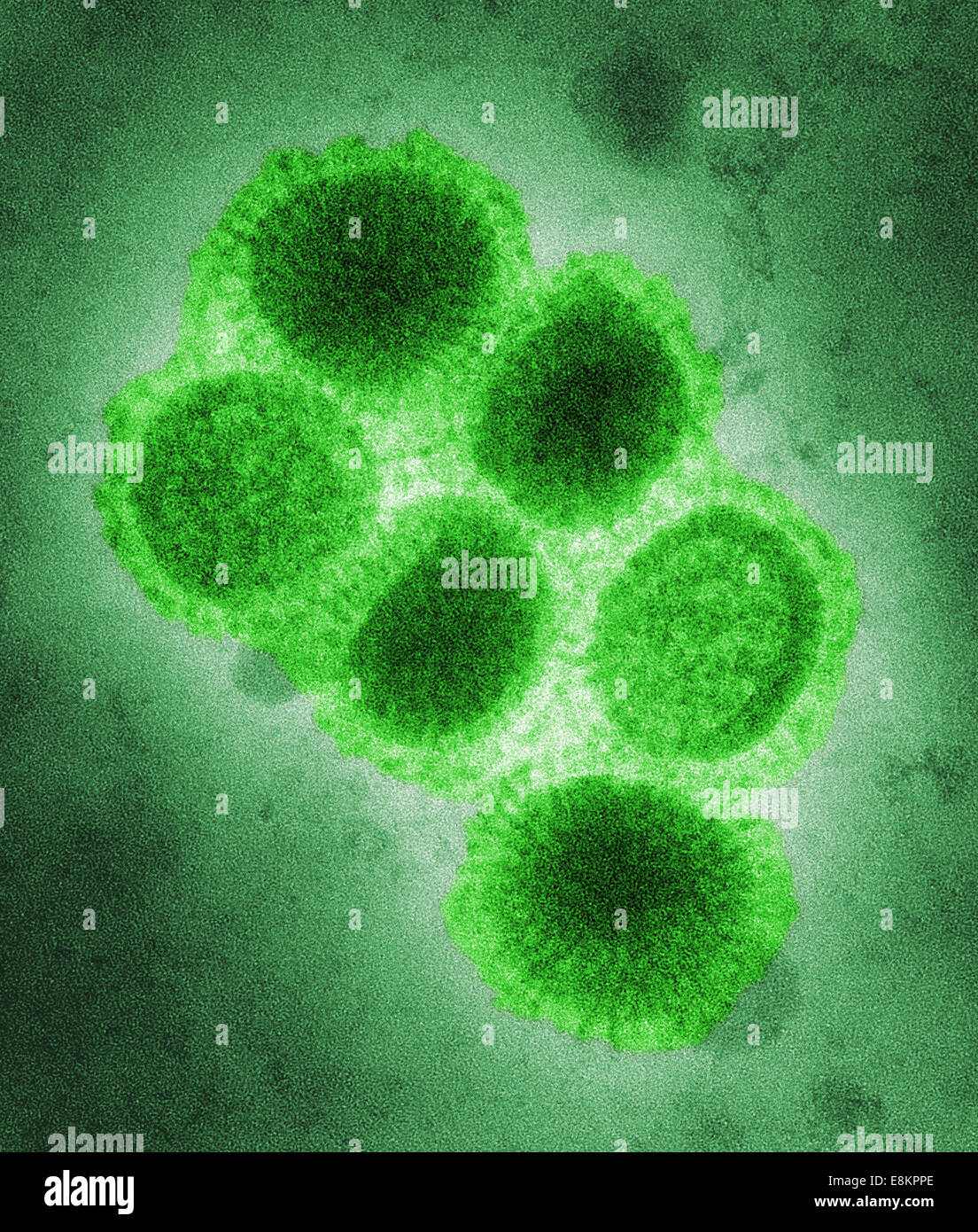 Questo colorato colorato negativo microscopio elettronico a trasmissione (TEM) illustrato alcuni dei cambiamenti ultrastrutturali morfologia di un/CA/4/09 Foto Stock