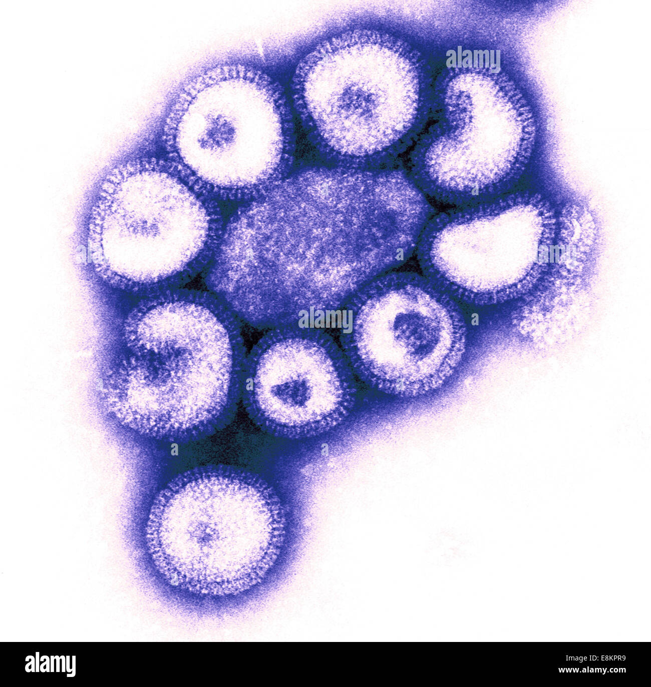 Questo negativo colorizzato macchiate di microscopio elettronico a trasmissione (TEM) illustra i dettagli ultrastrutturali del numero di influenza Foto Stock