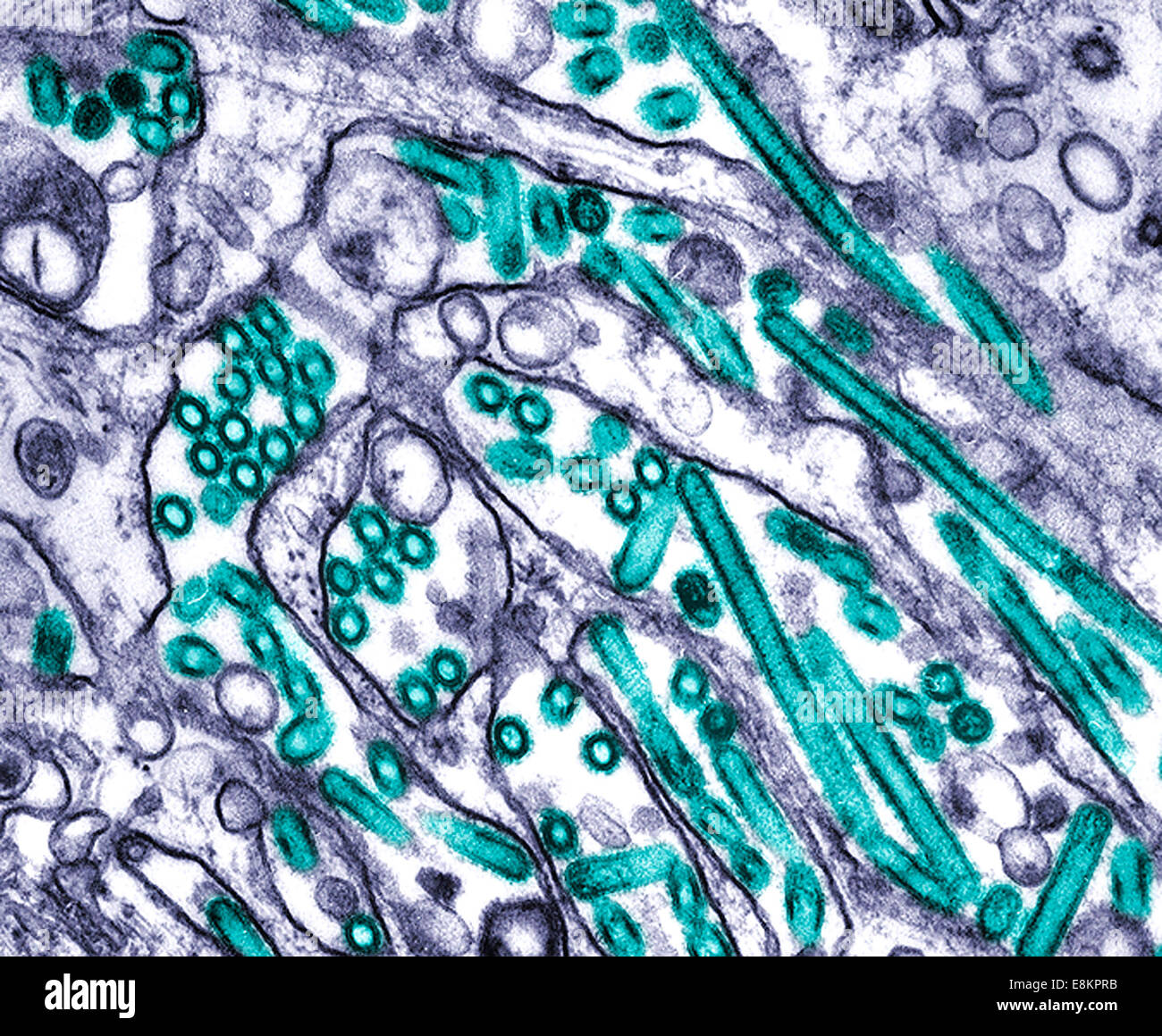 Colorizzato micrografia elettronica a trasmissione dell'influenza aviaria H5N1 virus coltivati in cellule MDCK i virus dell'influenza aviaria non Foto Stock