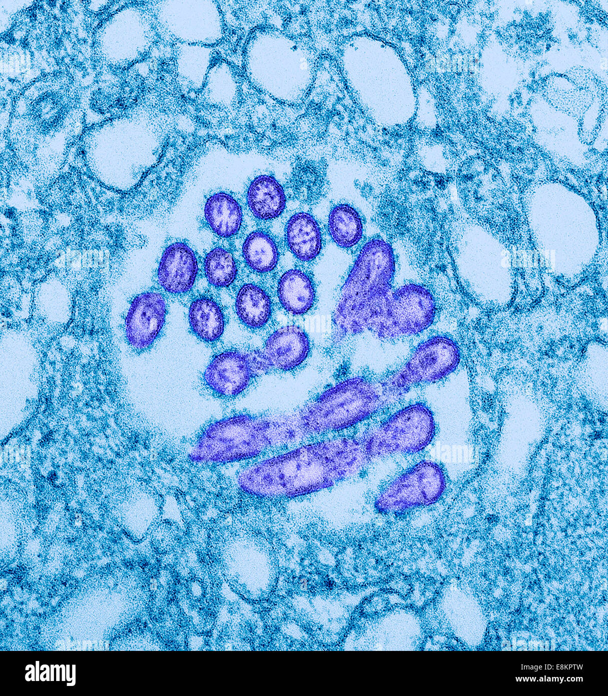 Questo colorizzato micrografia elettronica a trasmissione (TEM) hanno rivelato la presenza di un numero di nuovi virus H1N1 i virioni in questo tessuto Foto Stock