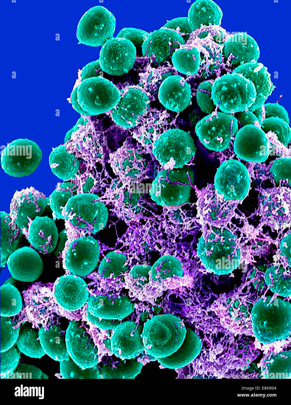 Micrografia elettronica a scansione di ammassarsi di Staphylococcus epidermidis batteri nella matrice extracellulare, che collega le cellule e Foto Stock
