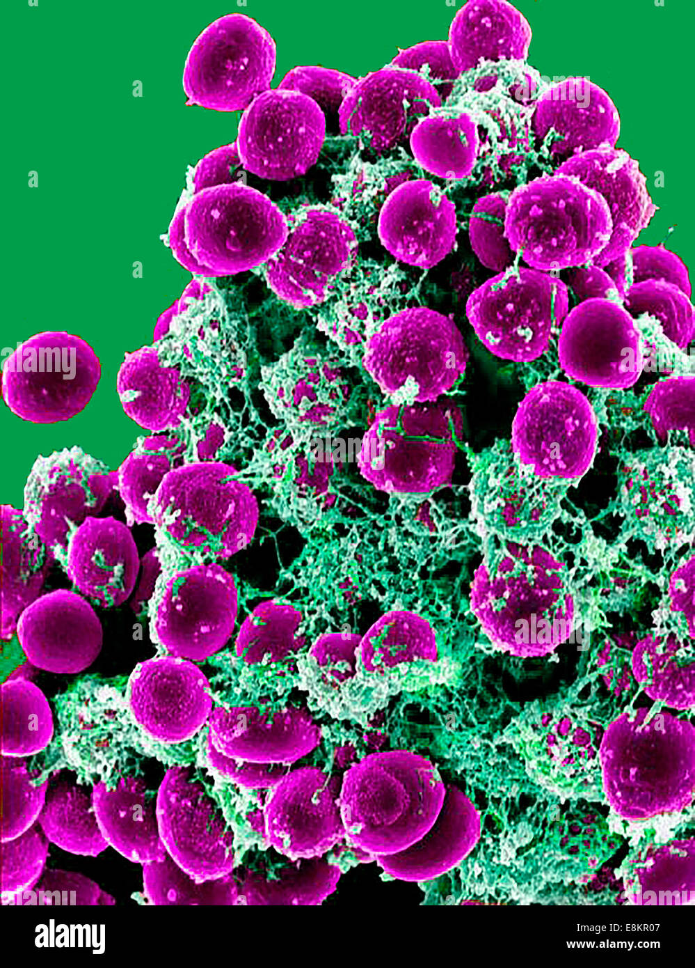 Micrografia elettronica a scansione di ammassarsi di Staphylococcus epidermidis batteri nella matrice extracellulare, che collega le cellule e Foto Stock Micrografia elettronica a scansione di ammassarsi di Staphylococcus epidermidis batteri nella matrice extracellulare, che collega le cellule e Foto Stock