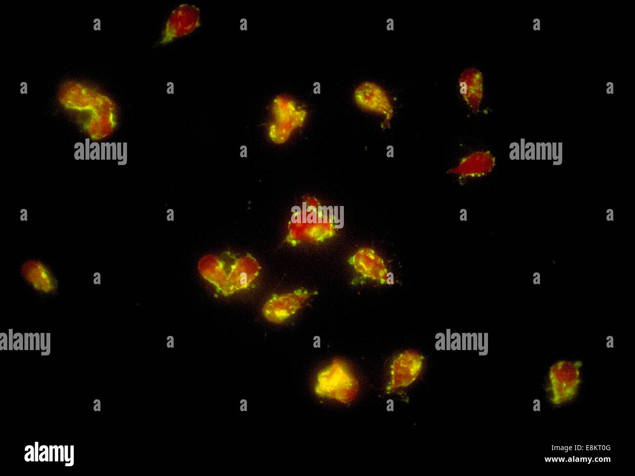 Questo fotomicrografia raffigura un positivo di anticorpo fluorescente indiretto (IFA) test per la Giardia lamblia parassiti. Foto Stock