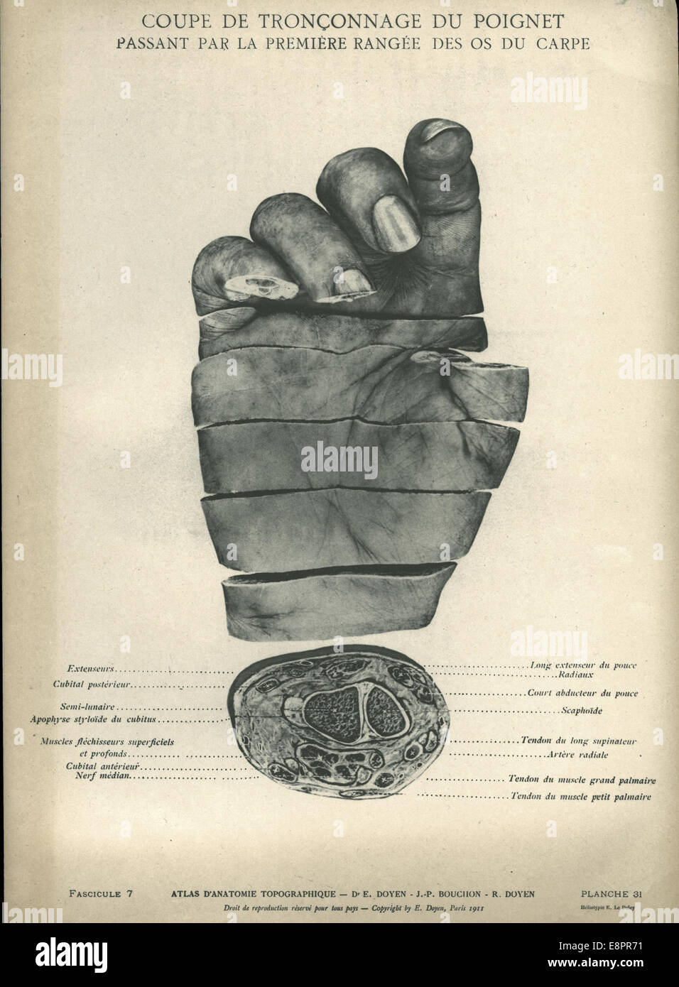 Appare in: Decano, Eugène-Louis, 1859-1916. Atlas d'anatomie topographique Descrizione immagine: l'immagine di destra mostra th Foto Stock
