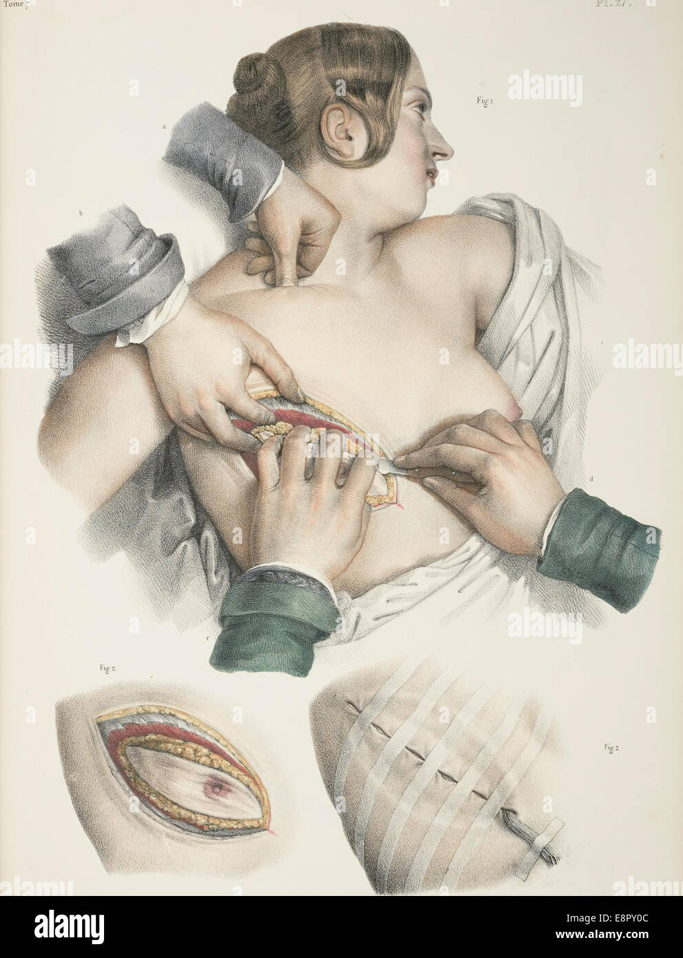 Appare in: Bourgery, J. M. (Jean Marc), 1797-1849. Traité complet de l'anatomie de l'homme Descrizione Immagine: illustra tre Foto Stock