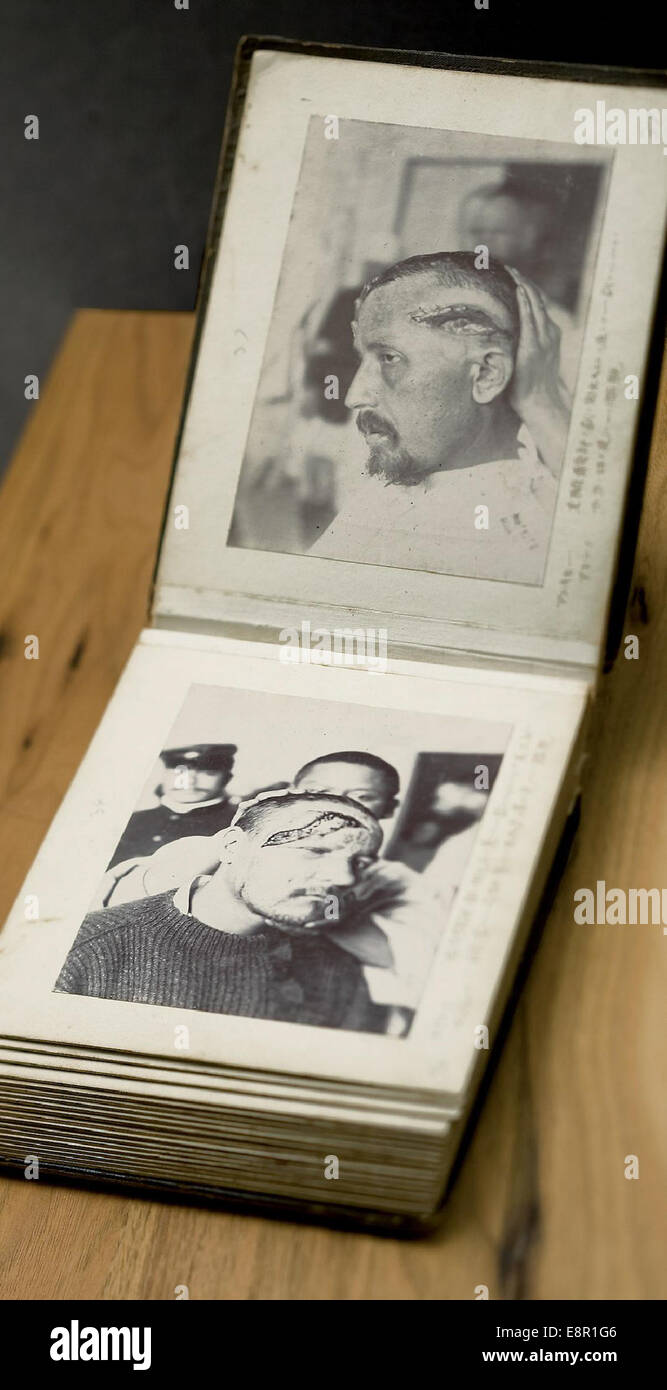 Una fotografia che mostra due immagini dell'album della guerra russo-giapponese, raffiguranti soldati russi maschi con ferite alla testa. Queste foto storiche documentano le dure realtà della guerra e il suo impatto sui soldati. Foto Stock