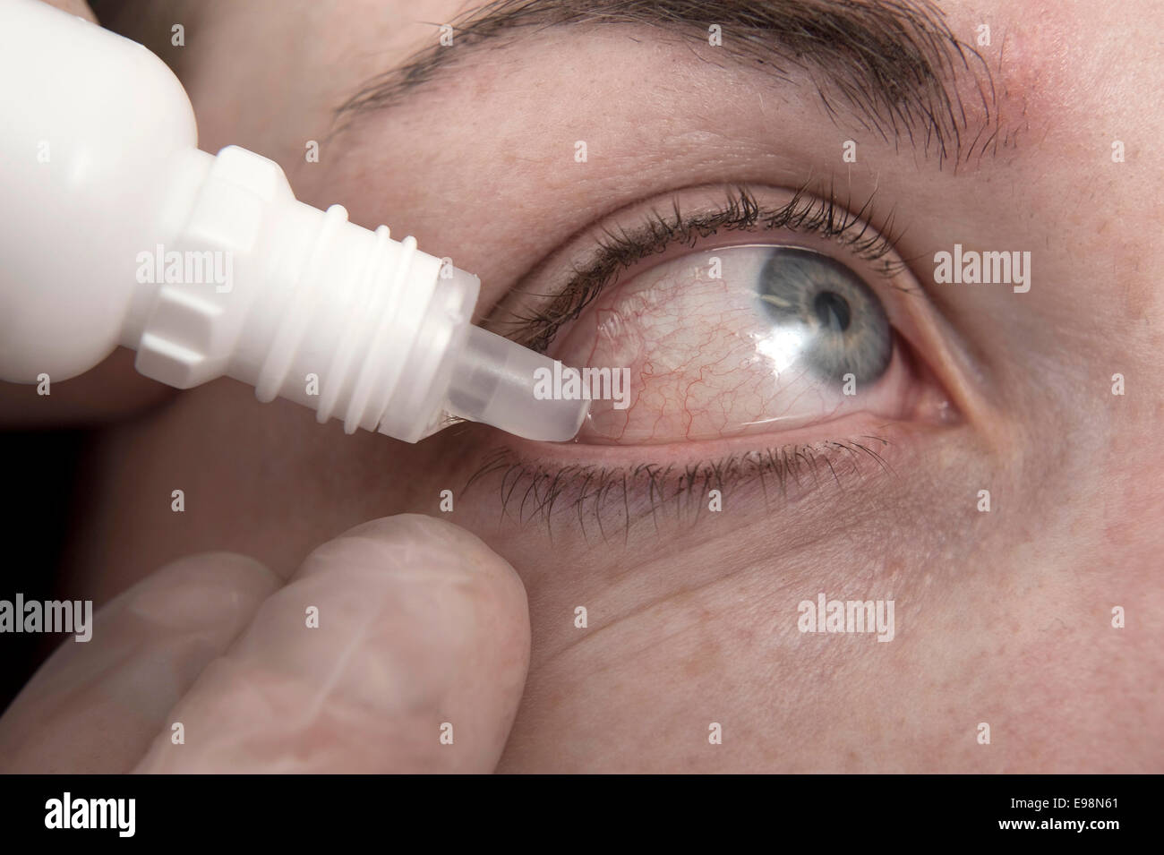 La formazione medica foto di un occhio avente collirio ad esso applicata tramite le mani con guanti in lattice su Foto Stock