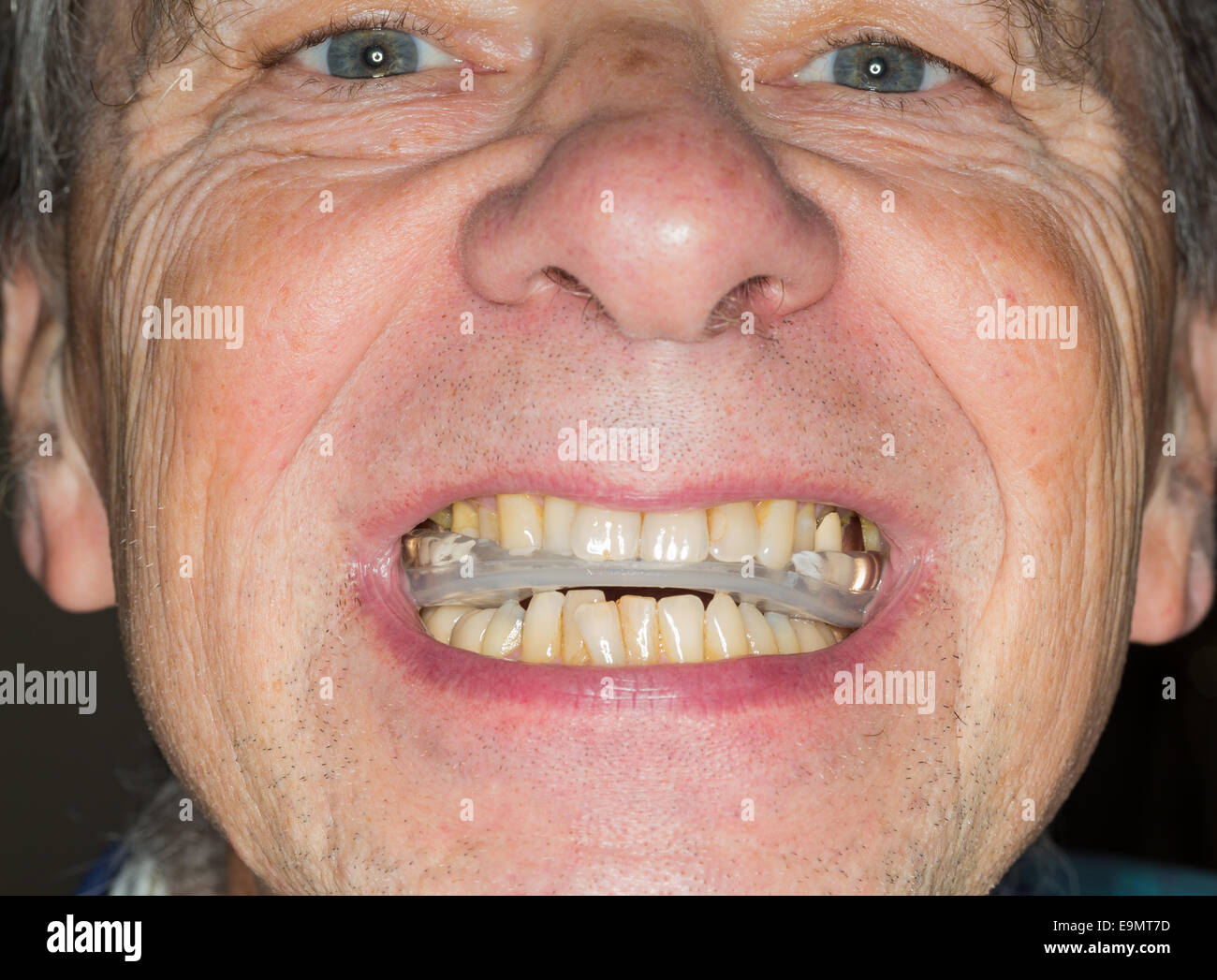 Close up della protezione dei denti in bocca senior Foto Stock