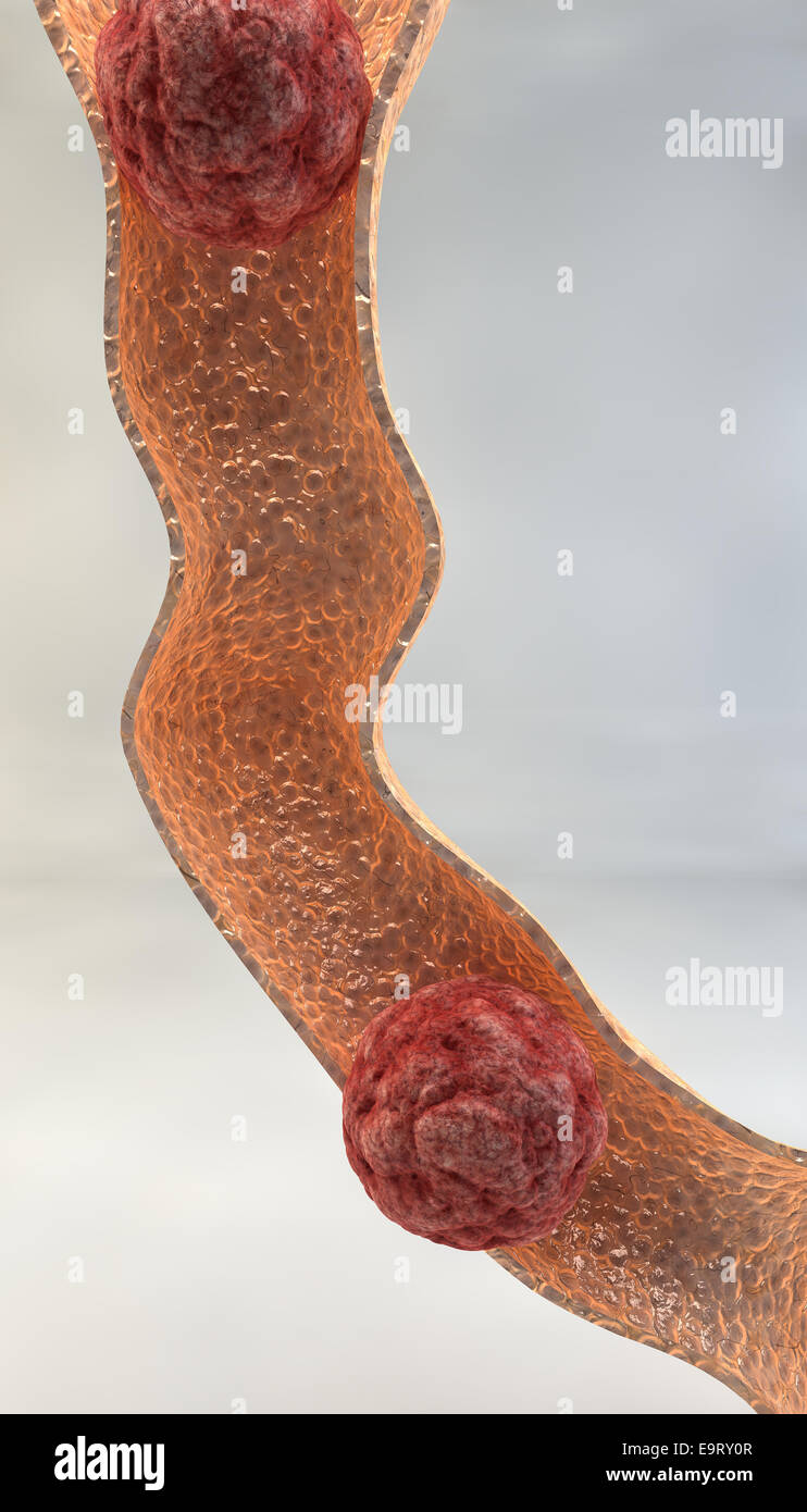 Esame dell'intestino close up Foto Stock