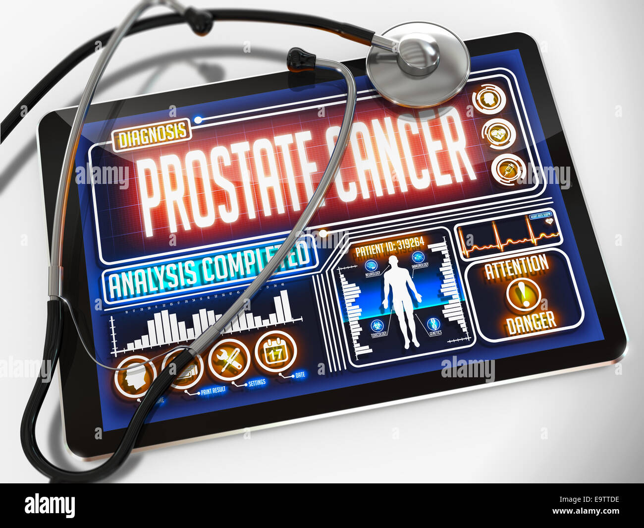 Medical Tablet con la diagnosi del cancro della prostata sul display e un stetoscopio nero su sfondo bianco. Foto Stock
