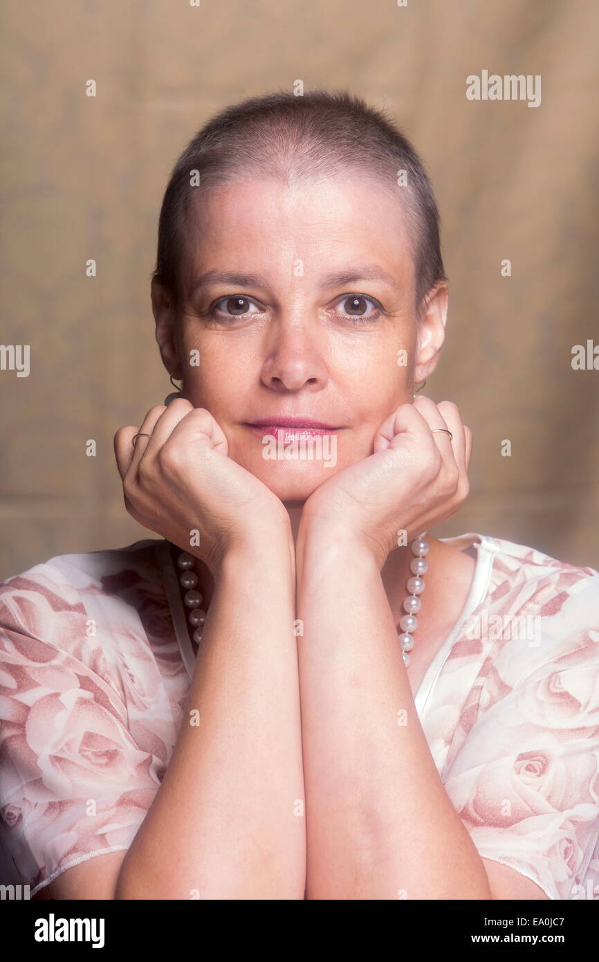Donna dopo la prima chemioterapia Foto Stock
