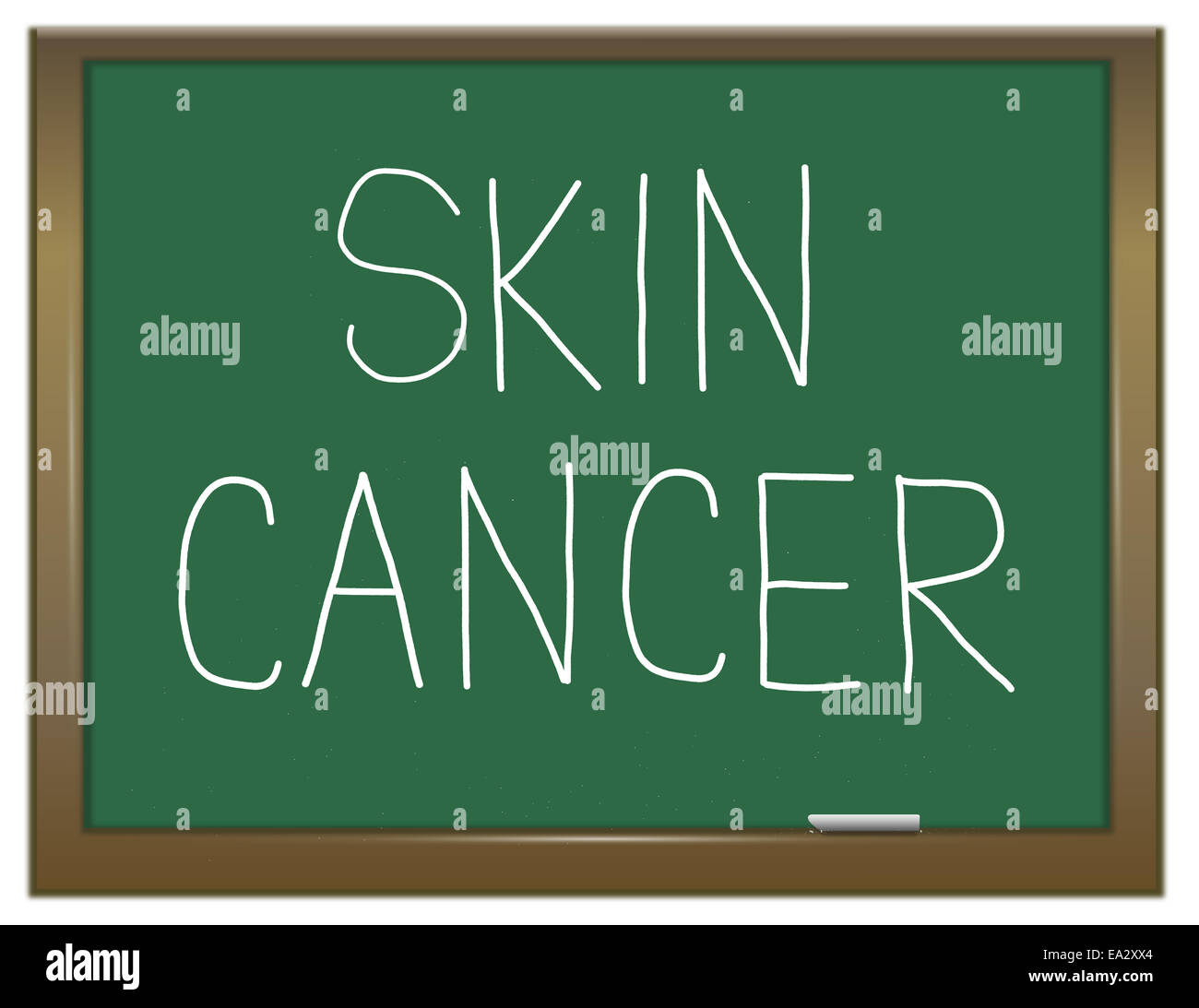 Il cancro alla pelle del concetto. Foto Stock