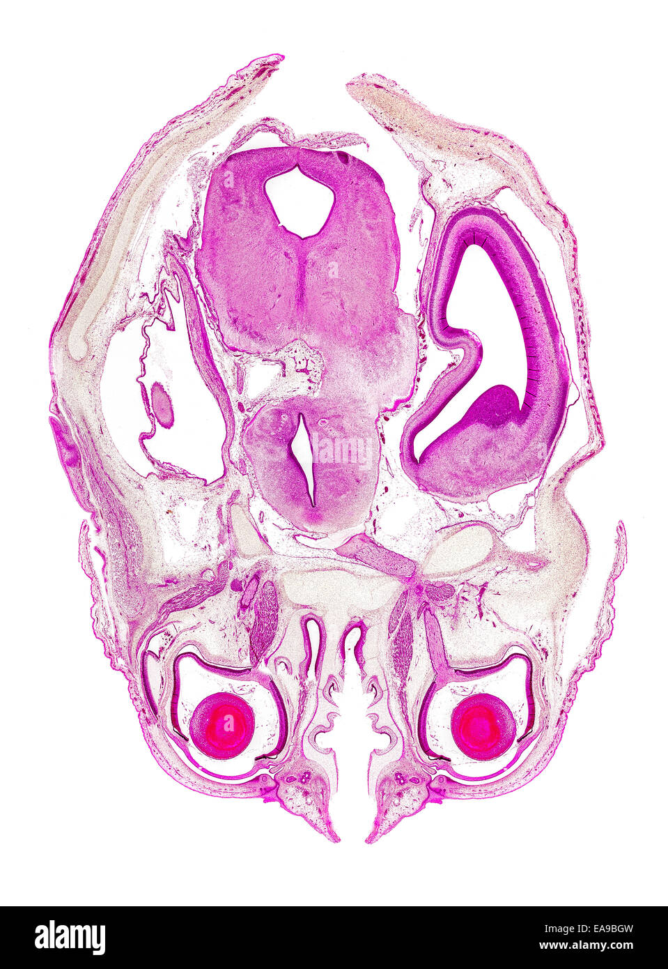 Feto umano testa colorate in sezione che mostra la struttura generale Foto Stock