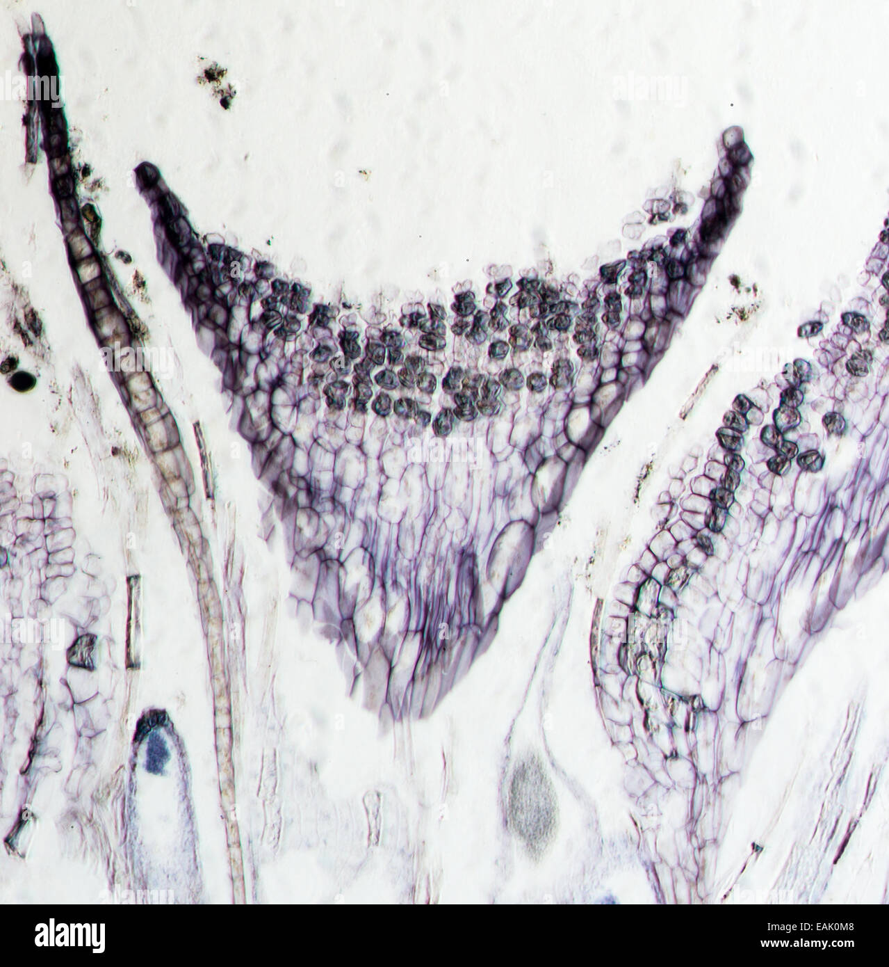 Moss antheridia, L.S. Antheridium. Micrografia di luce. Foto Stock