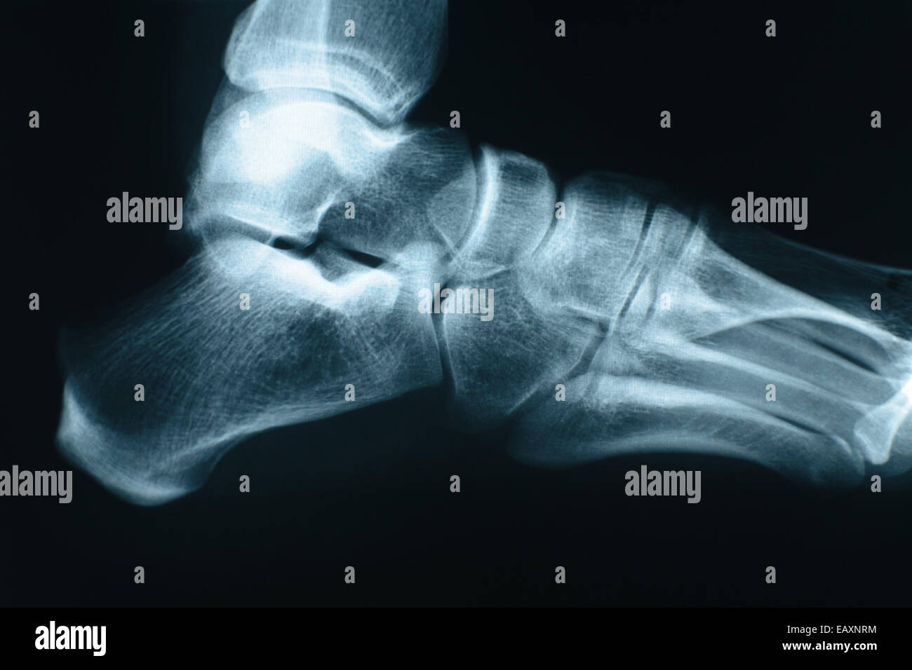 Xray colpo di piede destro realizzato in un ospedale. Foto Stock