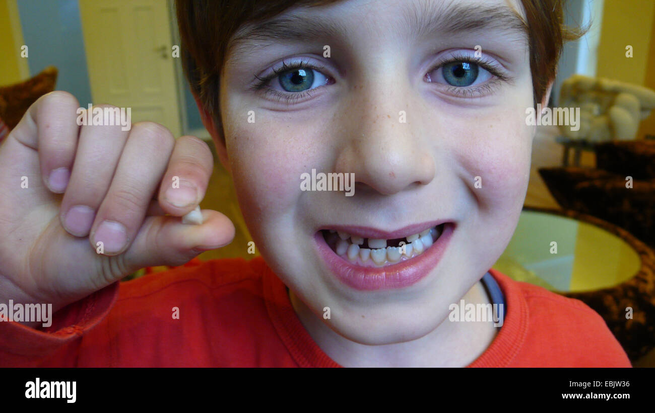 Little Boy che mostra un divario tra i suoi denti e un incisivo superiore appena caduto fuori Foto Stock