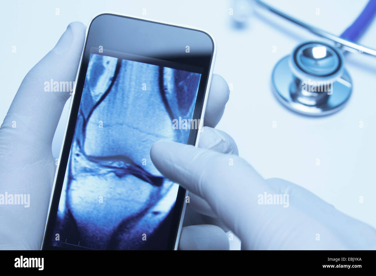 Uso della tecnologia nel settore sanitario. I medici le mani utilizza lo smartphone visualizza una Xray scansione TC del ginocchio Foto Stock