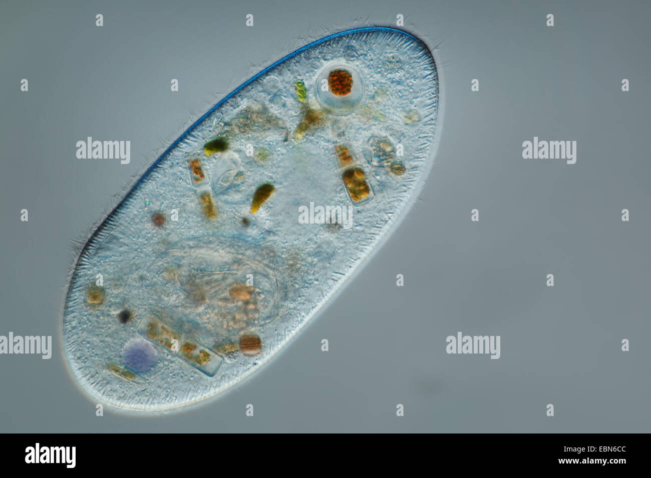 Frontonia (Frontonia), in Differential Interference Contrast Foto Stock