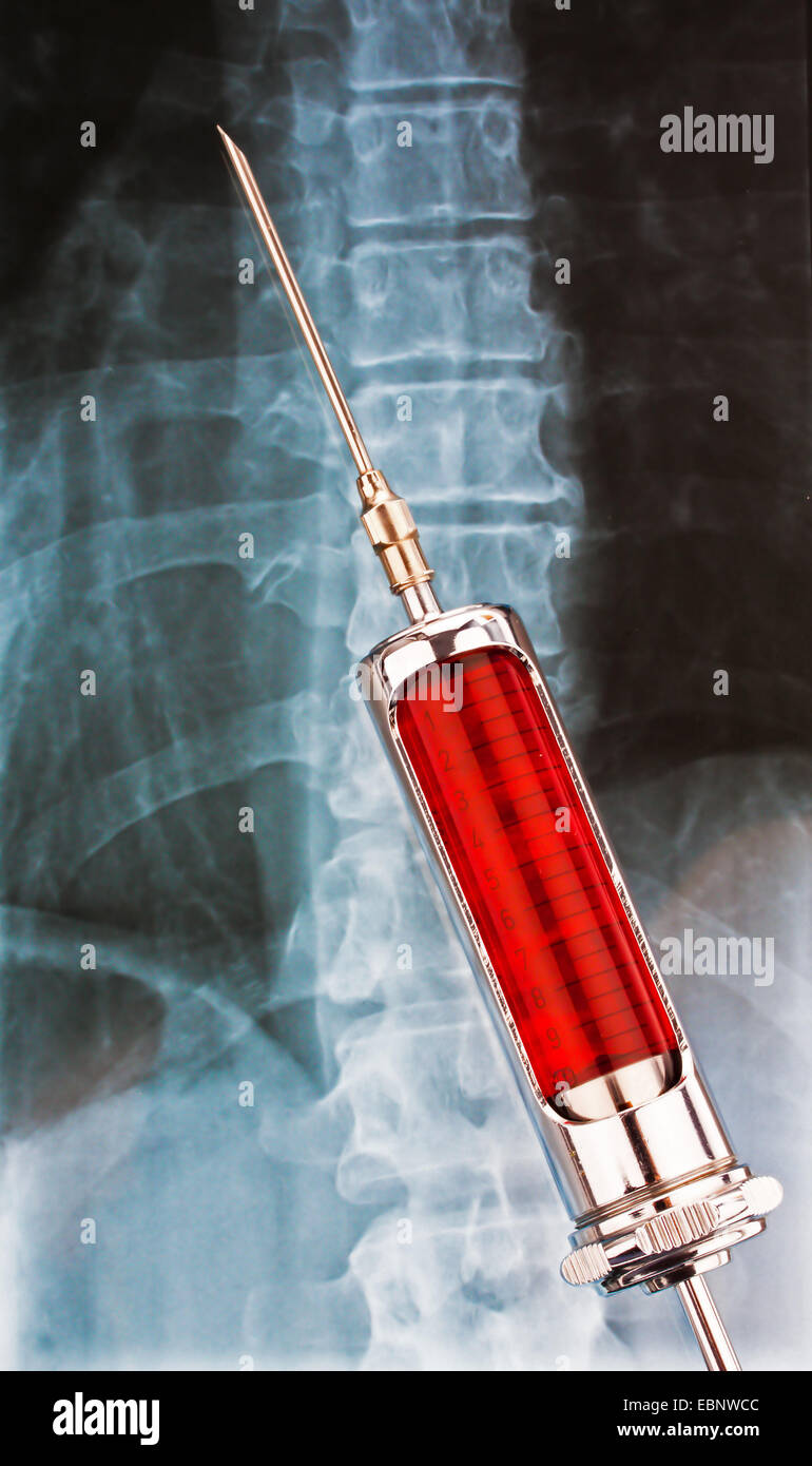 Ago e siringa nella parte anteriore di un x-ray Foto Stock