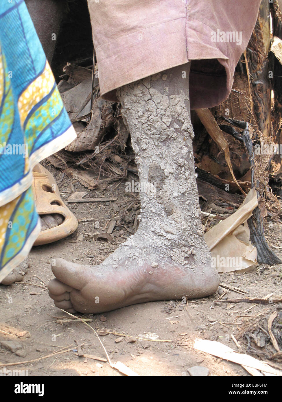Fango-coperto gamba di un elemento maschio della minoranza di Batwa che vive in una zona rurale, Burundi Bujumbura rurale, Mutimbuzi Foto Stock