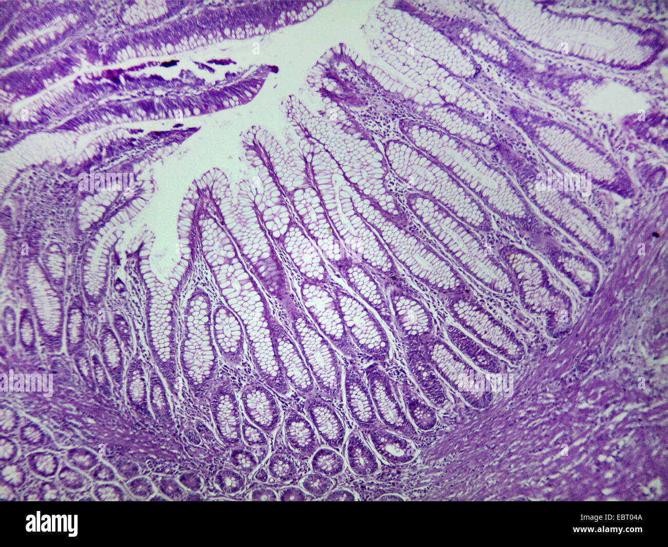 Persone, esseri umani, esseri umani (Homo sapiens sapiens), taglio microscopico di microscopici tagli, 100 x Foto Stock