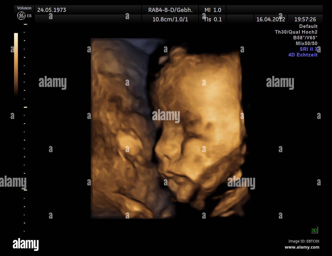 4D ritratto di un embrione nel grembo Foto Stock