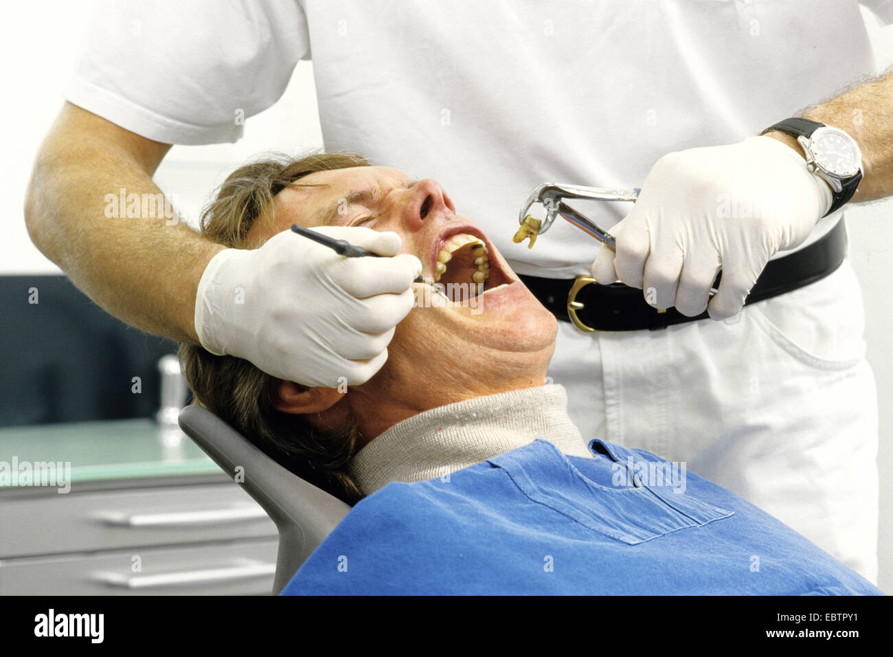 Dentista l'estrazione di un dente Foto Stock