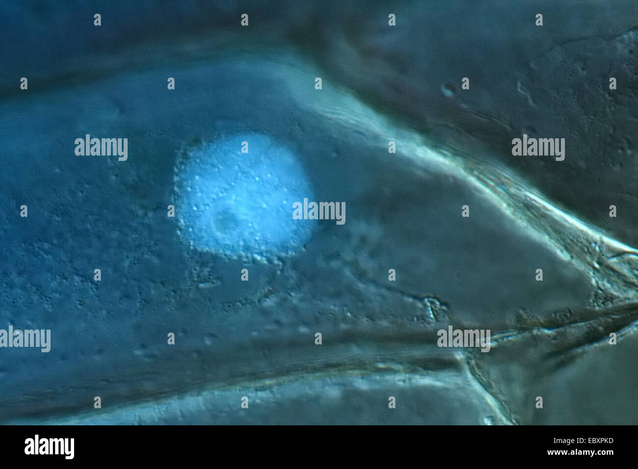 Parete cellulare, nucleo, e organelli del bulbo della cipolla scala cellule epidermiche Foto Stock