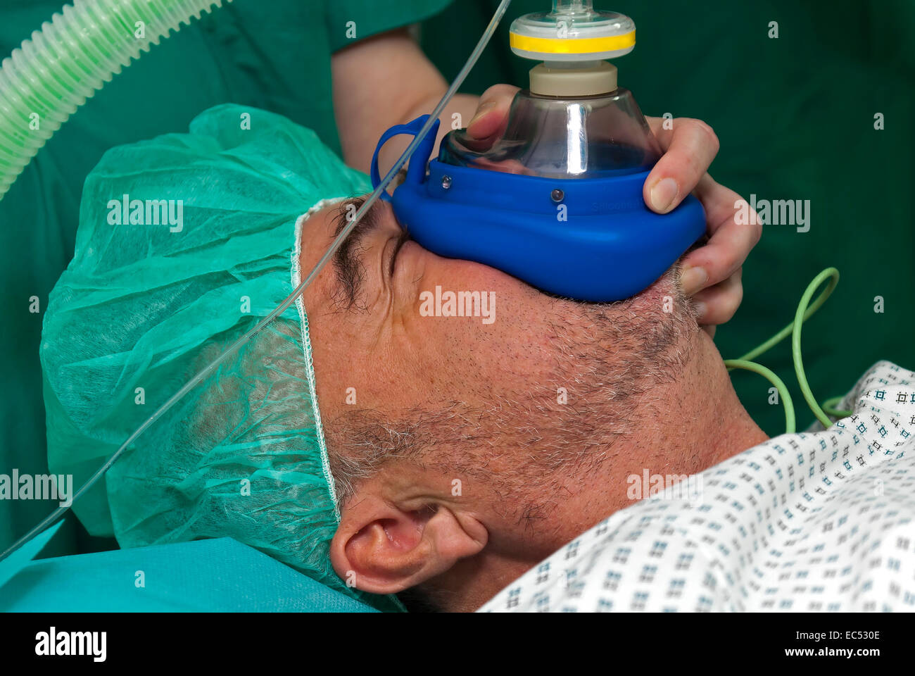Il paziente è ventilati in anestesia generale manualmente Foto Stock